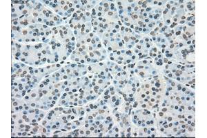 Immunohistochemical staining of paraffin-embedded lung tissue using anti-PLK1mouse monoclonal antibody. (PLK1 antibody)