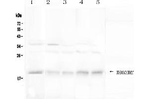 Western blot analysis of BAFF Receptor using anti-BAFF Receptor antibody .