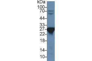 Western Blot; Sample: Rat Liver lysate; Primary Ab: 1µg/ml Rabbit Anti-Rat PRDX6 Antibody Second Ab: 0. (Peroxiredoxin 6 antibody  (AA 1-224))