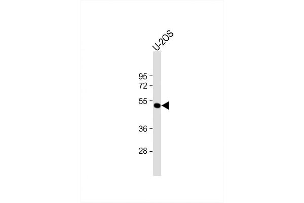 ANKH antibody  (C-Term)