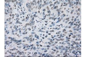 Immunohistochemical staining of paraffin-embedded colon tissue using anti-KDM4C mouse monoclonal antibody. (KDM4C antibody)