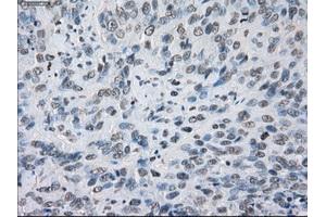 Immunohistochemical staining of paraffin-embedded colon tissue using anti-KDM4C mouse monoclonal antibody.