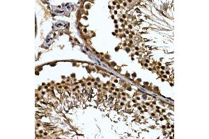 Immunohistochemistry of paraffin-embedded rat testis using ZNF384 Rabbit pAb (ABIN7271478) at dilution of 1:100 (40x lens). (ZNF384 antibody  (AA 1-180))