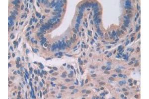 DAB staining on IHC-P; Samples: Mouse Uterus Tissue (LGALS3BP antibody  (AA 19-577))