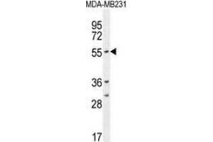 Western blot analysis in MDA-MB231 cell line lysates (35ug/lane) using CYP2A7  Antibody . (CYP2A7 antibody  (Middle Region))