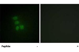 Immunofluorescence analysis of HepG2 cells, using RBMX polyclonal antibody .
