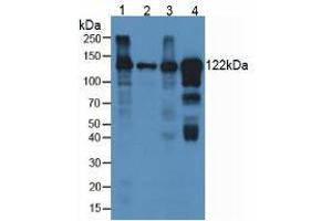Figure. (Ceruloplasmin antibody  (AA 872-1059))