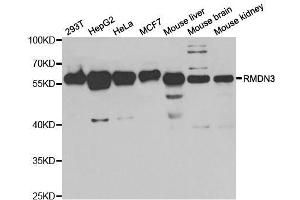 Western blot analysis of extracts of various cell lines, using RMDN3 antibody. (RMDN3 antibody  (AA 171-470))