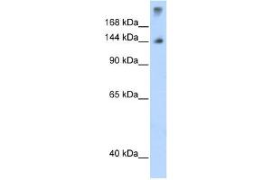 SF3B1 antibody used at 1.