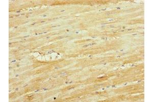 Immunohistochemistry of paraffin-embedded human heart tissue using ABIN7149113 at dilution of 1:100 (UQCRC1 antibody  (AA 1-63))