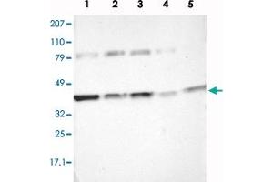 Western blot analysis of Lane 1: RT-4, Lane 2: EFO-21, Lane 3: A-431, Lane 4: Liver, Lane 5: Tonsil with IDH3G polyclonal antibody  at 1:250-1:500 dilution.
