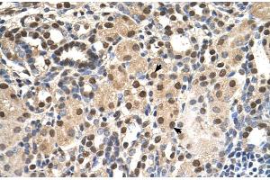 Human kidney (ANP32E antibody  (Middle Region))
