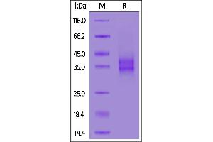 SDS-PAGE (SDS) image for Folate Receptor 1 (Adult) (FOLR1) (AA 25-232) (Active) protein (His tag,AVI tag,Biotin) (ABIN5526655)