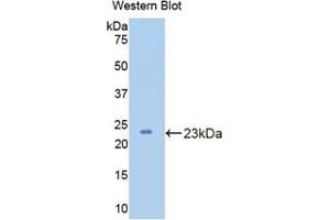 Detection of Recombinant CPN1, Human using Polyclonal Antibody to Carboxypeptidase N1 (CPN1) (CPN1 antibody  (AA 159-325))