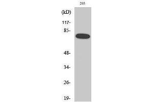 Western Blotting (WB) image for anti-Nuclear Factor-kB p65 (NFkBP65) (pSer468) antibody (ABIN3182087) (NF-kB p65 antibody  (pSer468))