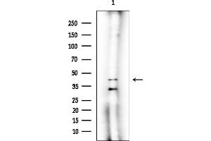 anti-STE20-Related Kinase Adaptor beta (STRADB) antibody