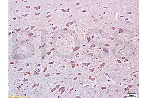 Formalin-fixed and paraffin embedded rat brain tissue labeled Anti-PEGF Polyclonal Antibody, Unconjugated (ABIN672456) at 1:200, followed by conjugation to the secondary antibody and DAB staining (PEDF antibody  (AA 201-300))