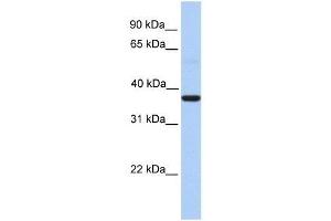 ZC3H15 antibody used at 0. (ZC3H15 antibody  (Middle Region))