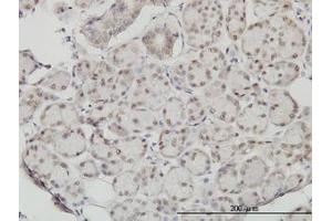 Image no. 1 for anti-Slingshot Homolog 3 (SSH3) (AA 293-392) antibody (ABIN599261) (SSH3 antibody  (AA 293-392))