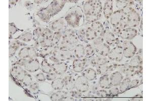 Image no. 1 for anti-Slingshot Homolog 3 (SSH3) (AA 293-392) antibody (ABIN599261)