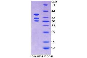 SDS-PAGE (SDS) image for Islet Cell Autoantigen 1, 69kDa (ICA1) (AA 1-257) protein (His tag) (ABIN1170784)