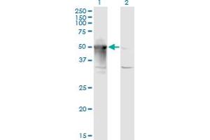 Western Blot analysis of ARMC6 expression in transfected 293T cell line by ARMC6 monoclonal antibody (M03), clone 2H8.