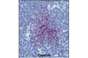 Formalin-fixed and paraffin-embedded human Thymus tissue reacted with SENP1 Antibody (N-term) (ABIN388042 and ABIN2845560) , which was peroxidase-conjugated to the secondary antibody, followed by AEC staining. (SENP1 antibody  (N-Term))