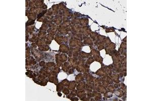 Immunohistochemical staining of human salivary gland with NDRG2 polyclonal antibody  shows strong cytoplasmic positivity in glandular cells at 1:2500-1:5000 dilution. (NDRG2 antibody)