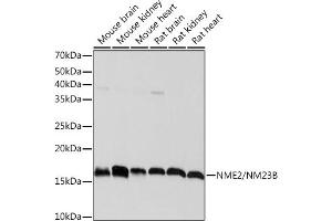 Western blot analysis of extracts of various cell lines, using NME2/NM23B Rabbit mAb (ABIN7269056) at 1:1000 dilution. (NME2 antibody)