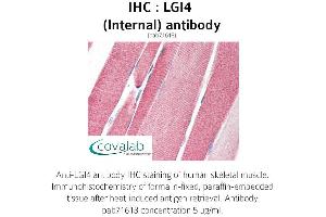 Image no. 3 for anti-Leucine-Rich Repeat LGI Family, Member 4 (LGI4) (Internal Region) antibody (ABIN1736431) (LGI4 antibody  (Internal Region))