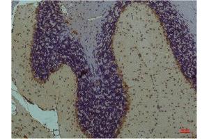 Immunohistochemistry (IHC) analysis of paraffin-embedded Mouse Brain Tissue using STAT3 Mouse Monoclonal Antibody diluted at 1:200. (STAT3 antibody)