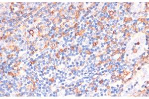 Immunohistochemistry of paraffin-embedded Human tonsil using CYBA Polyclonal Antibody at dilution of 1:100 (40x lens). (CYBA antibody)
