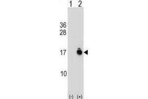 Western Blotting (WB) image for anti-Acylphosphatase 1, Erythrocyte (Common) Type (Acyp1) antibody (ABIN2999420)