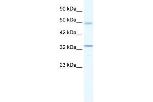 WB Suggested Anti-ZBTB7A Antibody Titration:  1. (ZBTB7A antibody  (Middle Region))