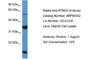 WB Suggested Anti-NTNG2  Antibody Titration: 0. (Netrin G2 antibody  (Middle Region))