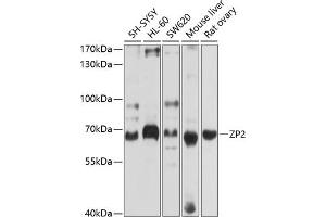 Western blot analysis of extracts of various cell lines, using ZP2 antibody (ABIN6128965, ABIN6150534, ABIN6150535 and ABIN6214263) at 1:1000 dilution. (ZP2 antibody  (AA 651-745))
