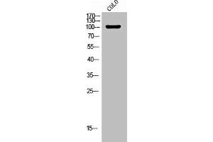 Western Blot analysis of COLO cells using Phospho-JIP-1 (T103) Polyclonal Antibody (MAPK8IP1 antibody  (pThr103))