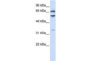 WB Suggested Anti-MED26 Antibody Titration:  0.