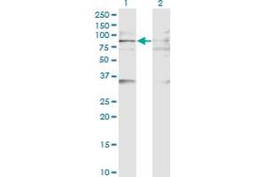 Western Blot analysis of BAZ2B expression in transfected 293T cell line by BAZ2B monoclonal antibody (M07), clone 2D10.