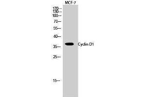 Western Blotting (WB) image for anti-Cyclin D1 (CCND1) (Ser166) antibody (ABIN3184144) (Cyclin D1 antibody  (Ser166))