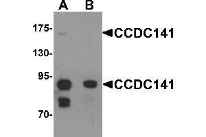 Western blot analysis of CCDC141 in SK-N-SH cell tissue lysate with CCDC141 antibody at 1 µg/mL in (A) the absence and (B) the presence of blocking peptide (CCDC141 antibody  (N-Term))