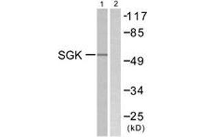 Western blot analysis of extracts from 293 cells, treated with heat shock, using SGK (Ab-78) Antibody.