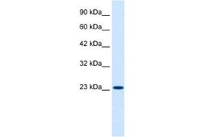 WB Suggested Anti-KCNIP2 Antibody Titration:  0. (KCNIP2 antibody  (N-Term))