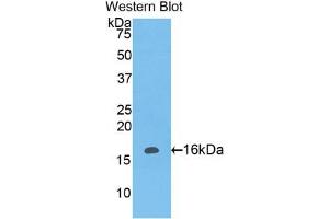 Detection of Recombinant LAIR2, Human using Polyclonal Antibody to Leukocyte Associated Immunoglobulin Like Receptor 2 (LAIR2) (LAIR2 antibody  (AA 21-152))