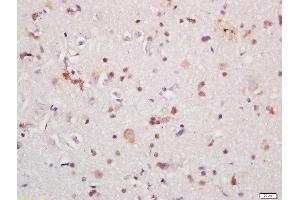 Formalin-fixed and paraffin embedded rat brain labeled with Rabbit Anti-IRAK1 Polyclonal Antibody, Unconjugated (ABIN1387749) at 1:200 followed by conjugation to the secondary antibody and DAB staining (IRAK1 antibody  (AA 301-400))