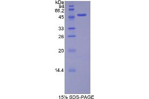 SDS-PAGE analysis of Rat FGF10 Protein. (FGF10 Protein)