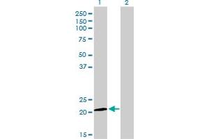 Western Blot analysis of ATF3 expression in transfected 293T cell line by ATF3 monoclonal antibody (M01), clone 6B8. (ATF3 antibody  (AA 1-181))