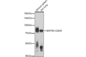 Western blot analysis of extracts of various cell lines, using ENTPD1/CD39 antibody (ABIN1679729, ABIN3018088, ABIN3018089 and ABIN6220354) at 1:1000 dilution. (CD39 antibody  (AA 1-180))