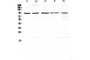 Western blot analysis of PRDM1/Blimp1 using anti-PRDM1/Blimp1 antibody . (PRDM1 antibody  (AA 1-230))