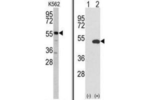 (LEFT) Western blot analysis of GPT antibody (N-term R133) in K562 cell line lysates (35 µg/lane).